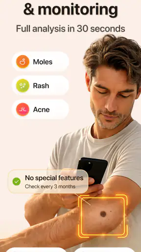 AI Skin Scanner & Mole checker