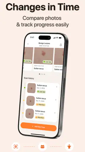 AI Skin Scanner & Mole checker