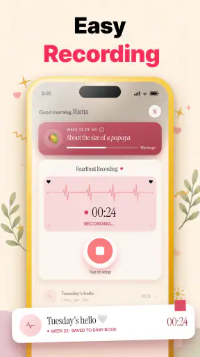 Baby Heartbeat Monitor : Cudly