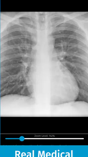 Full Code Medical Simulation