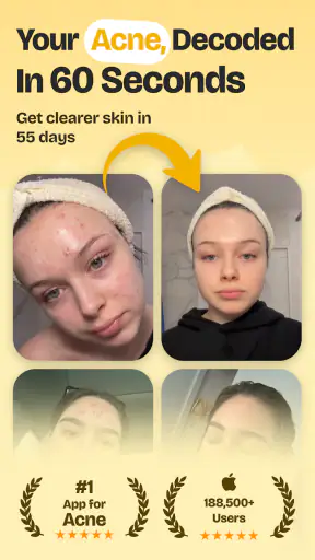 Puffin: Acne Tracker