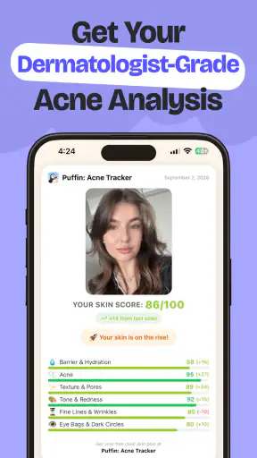Puffin: Acne Tracker