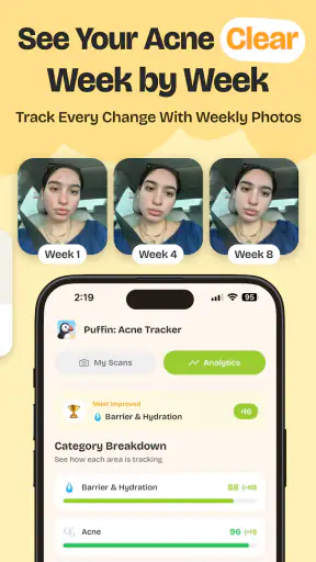 Puffin: Acne Tracker