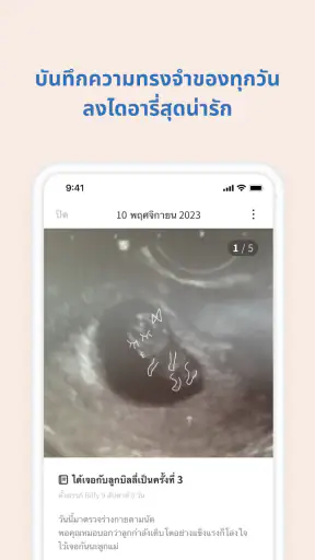 Baby Billy - ตั้งครรภ์&ลูกน้อย