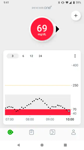 Dexcom ONE+