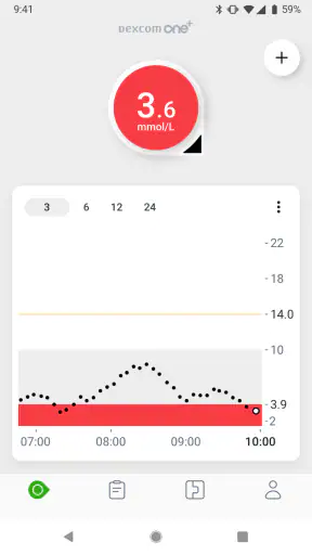 Dexcom ONE+