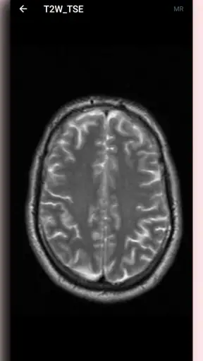 DICOM Viewer
