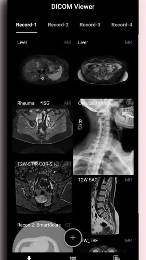 DICOM Viewer