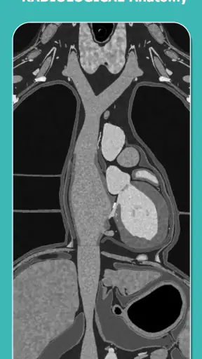 Anatomy Learning - 3D Anatomy