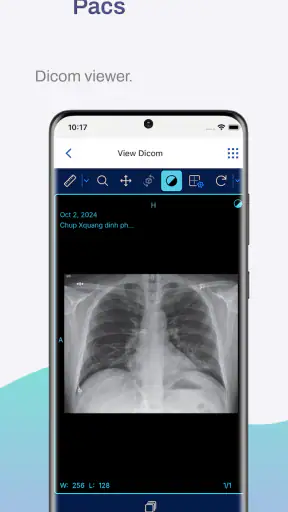 Eheal