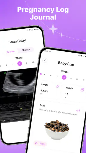 Pregnancy Track - Bump Journey